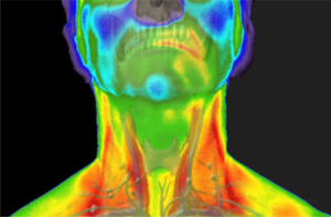 Imagen termográfica humano